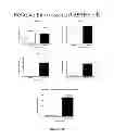 Fig. 20 - NEOPLASTIC CELLS GROWN ON DECELLULARIZED BIOMATRIX
