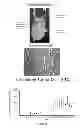 Fig. 25 - NEOPLASTIC CELLS GROWN ON DECELLULARIZED BIOMATRIX