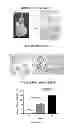 Fig. 26 - NEOPLASTIC CELLS GROWN ON DECELLULARIZED BIOMATRIX