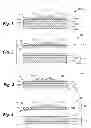 Fig. 02 - Prosthetic appliance transfer kit and method