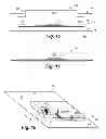 Fig. 06 - Prosthetic appliance transfer kit and method