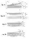 Fig. 07 - Prosthetic appliance transfer kit and method