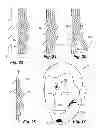 Fig. 08 - Prosthetic appliance transfer kit and method