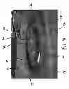 Fig. 09 - Synthetic putting green