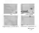 Fig. 03 - Adiponectin for Treating Pulmonary Disease