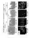 Fig. 06 - Gap junction-enhancing agents for treatment of necrotizing enterocolitis and inflammatory bowel disease