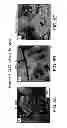 Fig. 09 - Gap junction-enhancing agents for treatment of necrotizing enterocolitis and inflammatory bowel disease