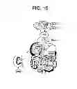 Fig. 16 - Methods of treating hepatic encephalopathy