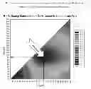 Fig. 02 - METHOD FOR PREVENTION OF STROKE