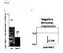 Fig. 05 - Methods for treating multiple sclerosis using antisense oligonucleotides