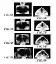 Fig. 06 - Ultrasonic-assisted molding of precisely-shaped articles and methods