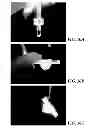 Fig. 07 - Ultrasonic-assisted molding of precisely-shaped articles and methods