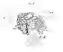 Fig. 04 - Dual Variable Region Antibody-Like Binding Proteins Having Cross-Over Binding Region Orientation