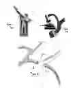 Fig. 08 - Methods for recanalization of vessels