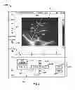 Fig. 06 - Diagnostic system and method for obtaining an ultrasound image frame