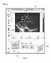 Fig. 07 - Diagnostic system and method for obtaining an ultrasound image frame
