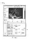 Fig. 08 - Diagnostic system and method for obtaining an ultrasound image frame