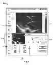 Fig. 09 - Diagnostic system and method for obtaining an ultrasound image frame