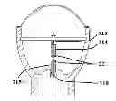 Fig. 01 - Increase electrode life in devices used for extracorporeal shockwave therapy (ESWT)