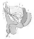 Fig. 01 - CATHETERS