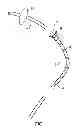 Fig. 02 - CATHETERS