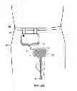Fig. 07 - CATHETERS
