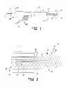 Fig. 02 - MEDICAL FLUID DELIVERY SYSTEM