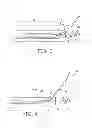 Fig. 03 - MEDICAL FLUID DELIVERY SYSTEM