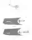 Fig. 02 - CATHETER SYSTEM