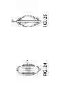 Fig. 22 - Single use delivery device having a primer element