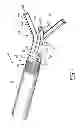 Fig. 02 - Drain catheter