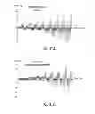 Fig. 13 - System and method for estimating a treatment volume for administering electrical-energy based therapies
