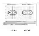 Fig. 18 - System and method for estimating a treatment volume for administering electrical-energy based therapies