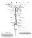 Fig. 01 - Endometrial ablation method