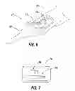 Fig. 04 - Rapid exchange IOL insertion apparatus and methods of using