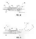 Fig. 07 - Rapid exchange IOL insertion apparatus and methods of using