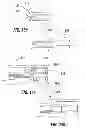 Fig. 10 - Rapid exchange IOL insertion apparatus and methods of using