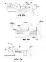 Fig. 12 - Rapid exchange IOL insertion apparatus and methods of using