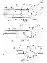 Fig. 17 - Rapid exchange IOL insertion apparatus and methods of using