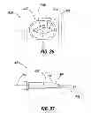 Fig. 18 - Rapid exchange IOL insertion apparatus and methods of using