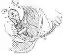 Fig. 01 - Uterine manipulator assemblies and related components and methods