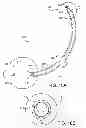 Fig. 15 - Uterine manipulator assemblies and related components and methods