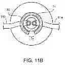 Fig. 18 - Uterine manipulator assemblies and related components and methods