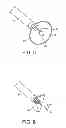 Fig. 04 - Aortic valve repair