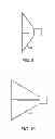 Fig. 06 - Aortic valve repair