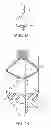 Fig. 08 - Aortic valve repair