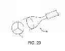 Fig. 16 - Aortic valve repair