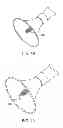 Fig. 29 - Aortic valve repair