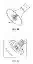 Fig. 32 - Aortic valve repair