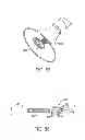 Fig. 33 - Aortic valve repair